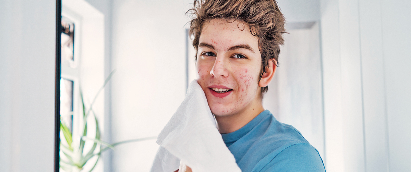 I have a lot of small pimples; is it okay to put spot treatment all